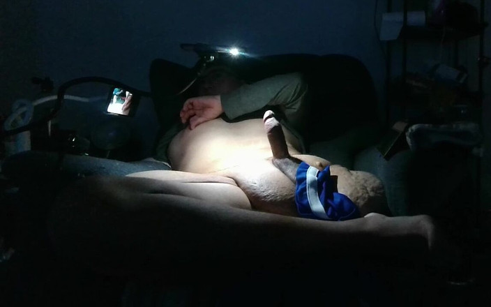 Lymph Guy: Amputee bangun untuk memotret beban tebal besar