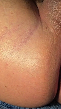 Brazilian Wax Asshole