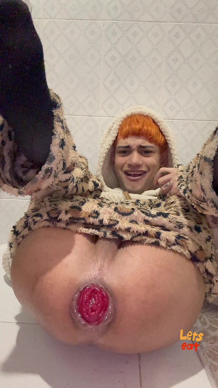 Anders: Time to Train This Prolapse