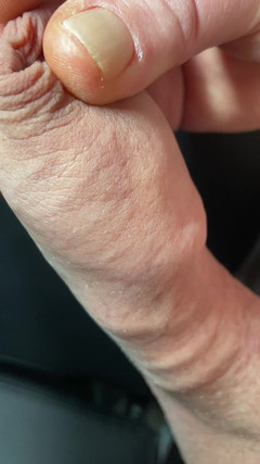 Foreskinguy: Enorme onbesneden voorhuid pik aftrekken