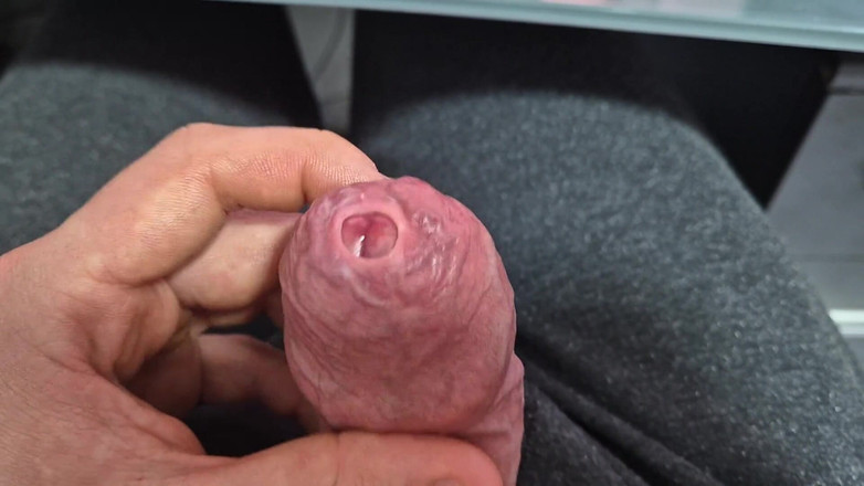 GloomyChase977: Strakke phimosis voorhuid uitrekken met cumshot!