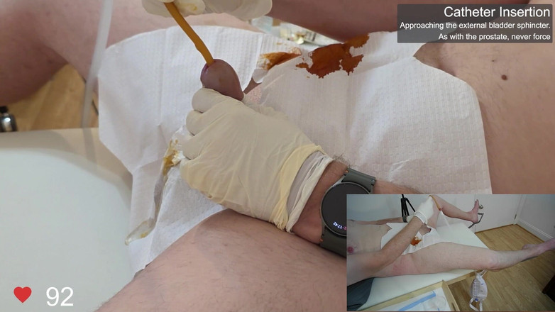 Clinical Climax: Kathetereinschub