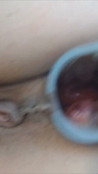 Anal muayene