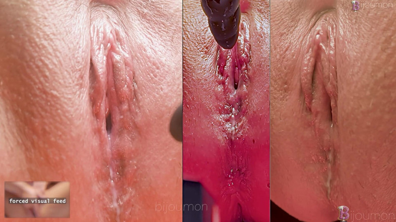 Bijoumon: Terapia de conversão lésbica