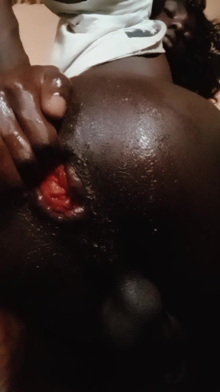 AkiraNami: 拳交黑屁股和脱垂