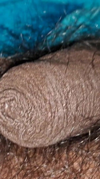 Hairy Panes