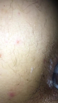Anal Insertion