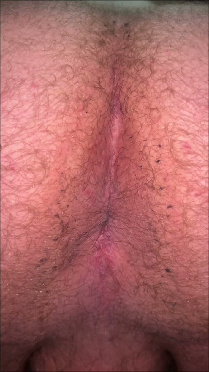 Makssssimus: Dirty Fatass Ass and a Tiny Dick
