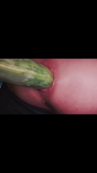 Anal Dilatation Gaping Hole