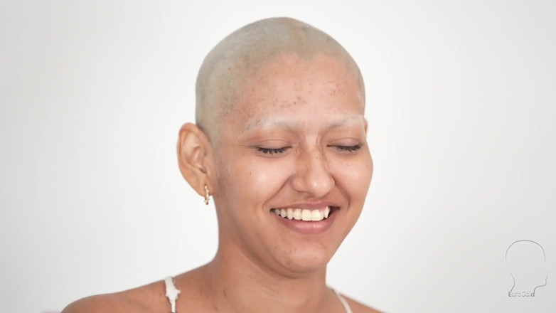 Euro Bald: Hindi