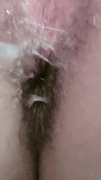 What Happened in My Ass