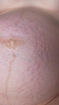 Belly Movements