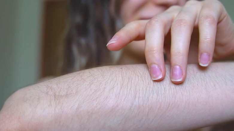 Rarible Diamond: Chlupaté paže a jámy