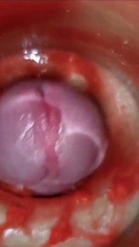 Cumfeti Goteando Preñada Compilación - Vista De Endoscopia