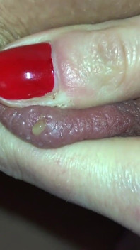 Clítoris euroslut, coño y pezones, bombeo al vacío, orgasmo