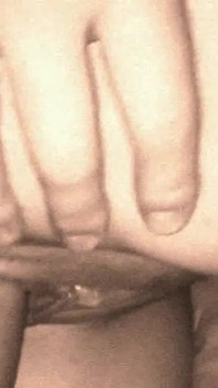 My Second Penis