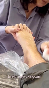 Depilación a Un Varón En Medias De Dos Enfermeras Con Guantes