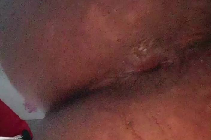 Renata Himalaya: Onanerar med aubergine rev min anus