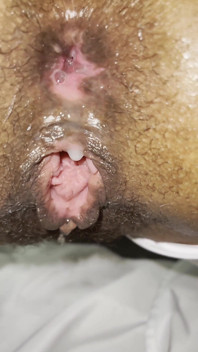Pink Foxx, Creampie Anal Dégoulinant
