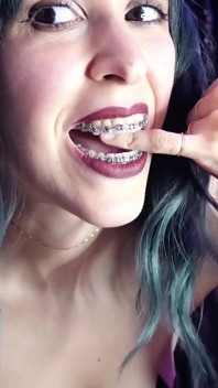 Biting My Fingers - Bite, Mouth, Teeth, Braces, Fetish Ita
