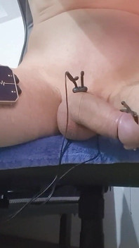 E-stim Hfo