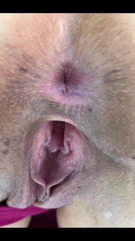 Gaping Stretched