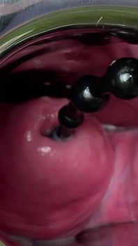 Crazywifeslut Cervix and Peehole Play