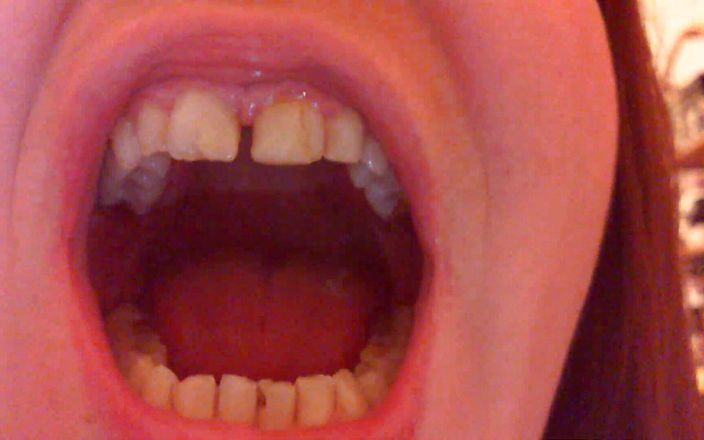 Nicoletta Fetish: दांतों वाली कामुक ताकाझांकी
