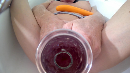 Lizzy Yum: Lizzy Yum  2022 #14 - Speculum dildo and post op pussy stretching