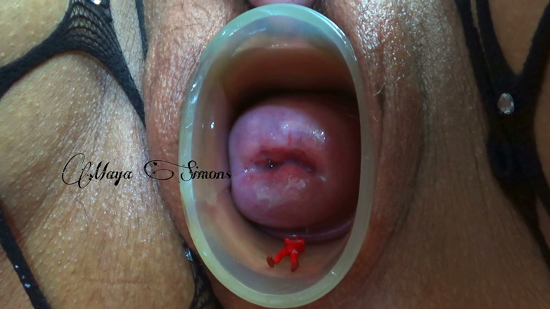 Maya Simons: This Is What My Cervix Looks Like After a Year...