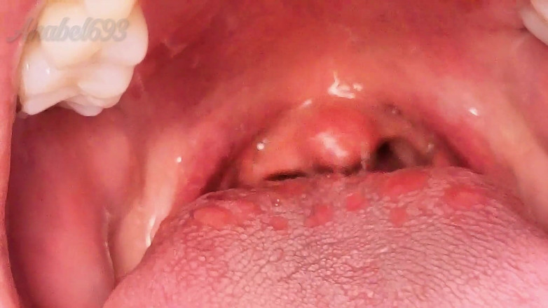 anabel693: Ağız fetişi uvula kapanıyor Güçlü bir BBC'de boğuluyorum
