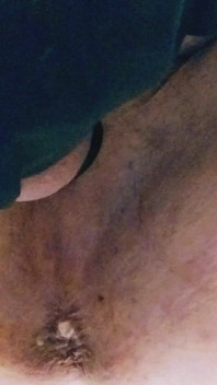 Park and Ride Breeding.