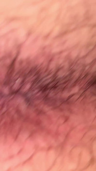 Close up Hairy Hole