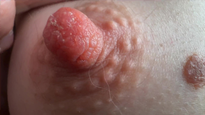 Skinny_lady69: Pezones super de cerca