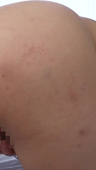 Eimi-chan's anus fetiš masturbace pokryté hýžděmi