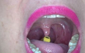 Swallowing a Car
