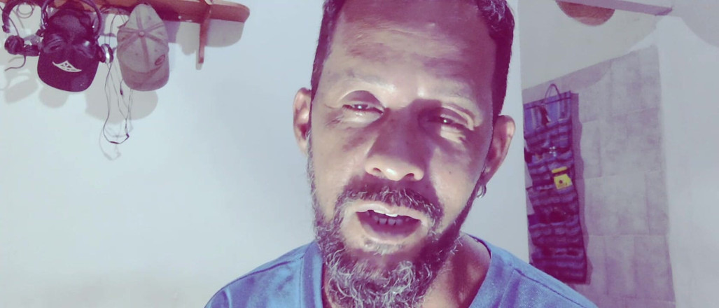 Stink HairyMale: Olhe Pra Mim