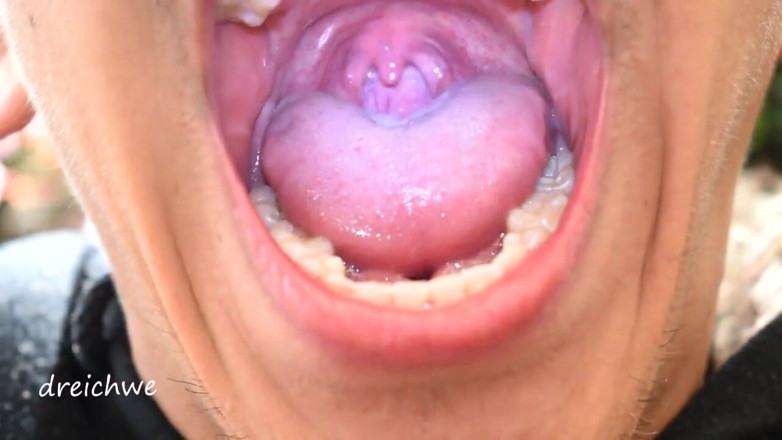 Dreichwe: Uvula fetisch mun