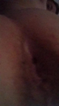 Pulse Ass