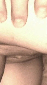 My Second Penis