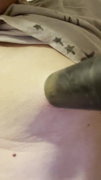 Aspirando meus peitos
