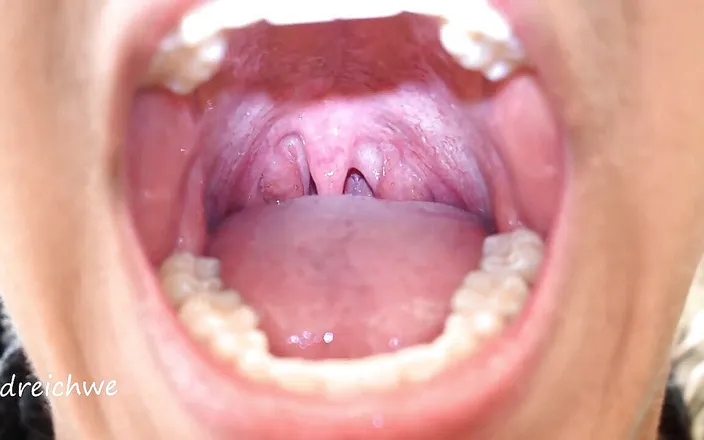 Dreichwe: Uvula fetish mouth