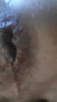 Antrenament anal și prolaps rectal 2