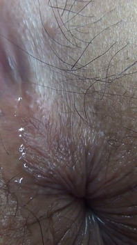 Extreme Close-up of an Anus