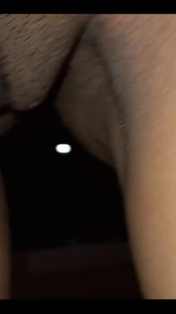 Depilação labial