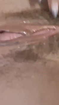拡張