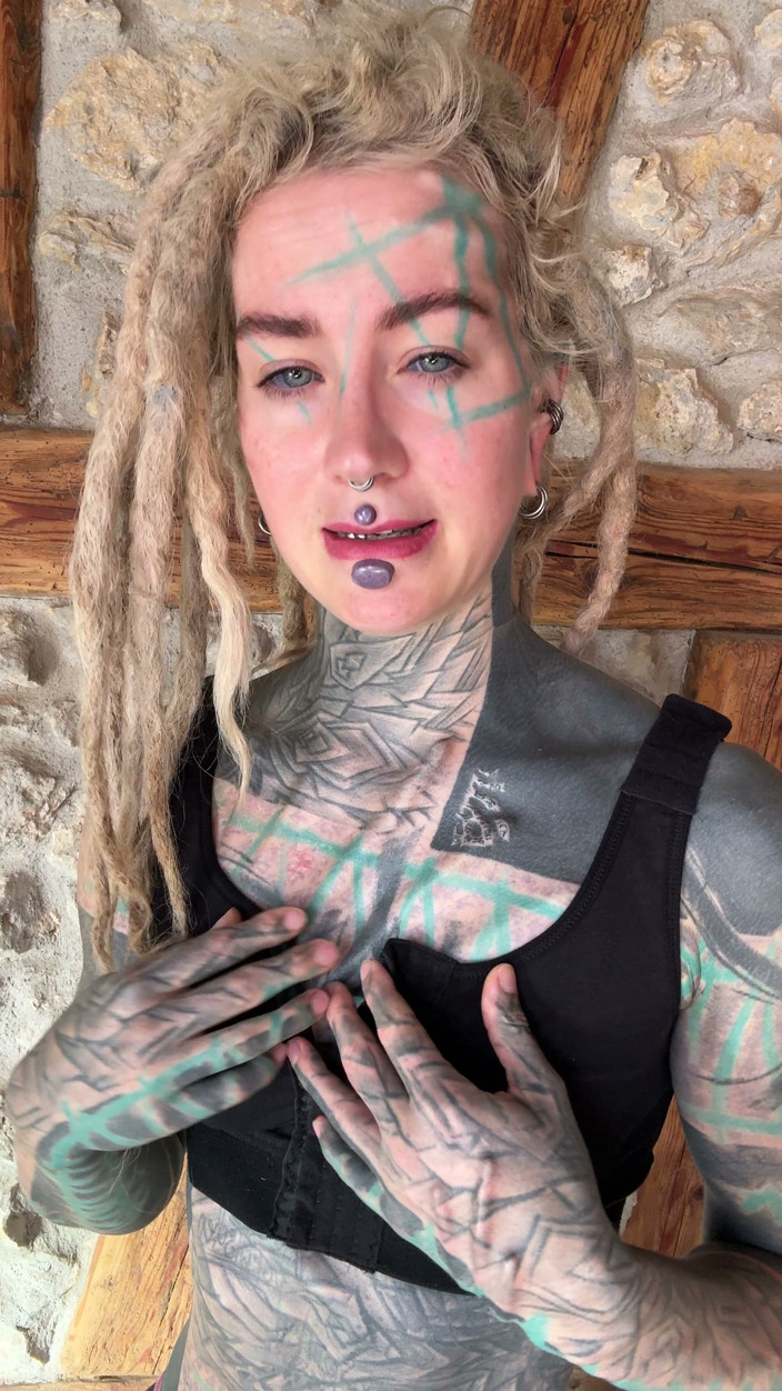 Anuskatzz: I Got New Boobs and an Upper Blephoplasty. I Will...