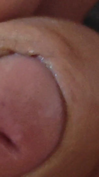 Large Foreskin and Balls in Striking Close-up.