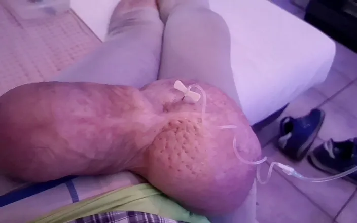 Monster_Meat_: Filling up with 1liter glucose