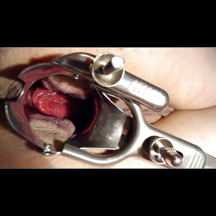 Putarankahotmilf: Speculum anál, výhřez, dej mi vodu do zadku a kundičky, šukání,...